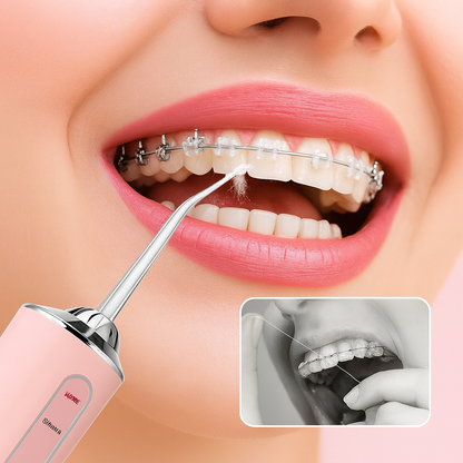 Irrigador Dental Recargable Portátil - Limpieza Oral Profesional